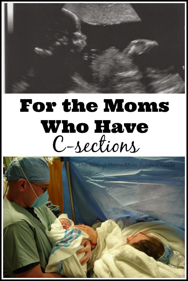 To the moms who have c-sections, you are strong and your birth story is valid too. My experiences having 3 c-sections and 4 kids-and it was all worth it!